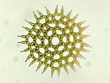 ▲Lake Biwa Phytoplankton (Pediastrum biwae)