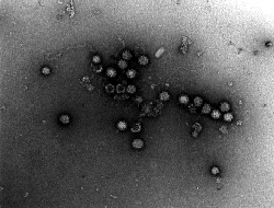 ノロウイルス電子顕微鏡画像