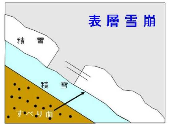 表層雪崩