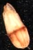 もみ枯細菌病による玄米の被害の写真