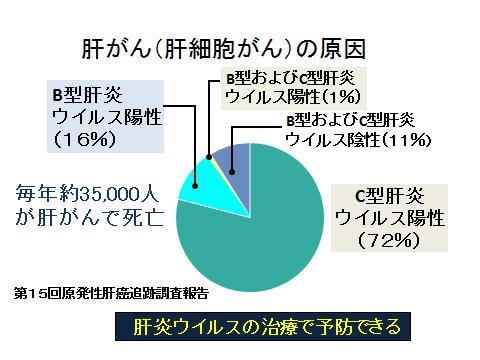 肝がん(肝細胞がん)の原因 第15回原発性肝癌追跡調査報告 毎年約35,000人が肝がんで死亡 B型肝炎ウイルス陽性(16%)B型およびC型肝炎ウイルス陽性(1%)B型およびC型肝炎ウイルス陰性(11%)C型肝炎ウイルス陽性(72%)肝炎ウイルスの治療で予防できる