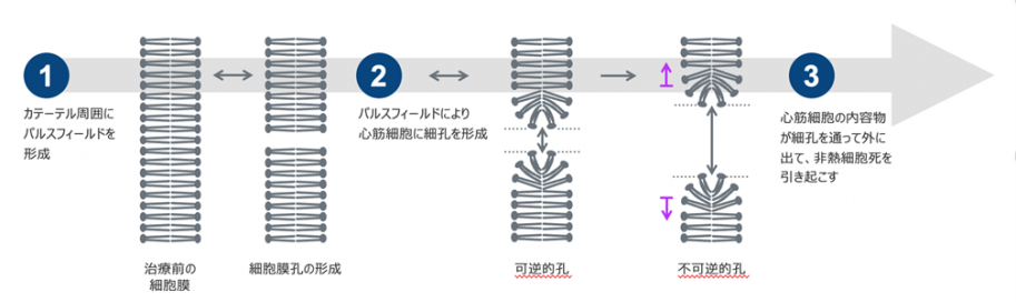 PFAの原理について