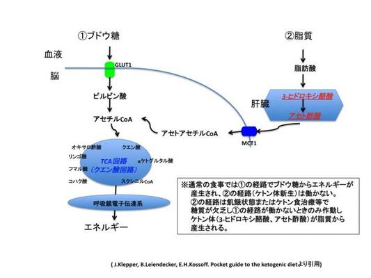 ケトン食治療の図1