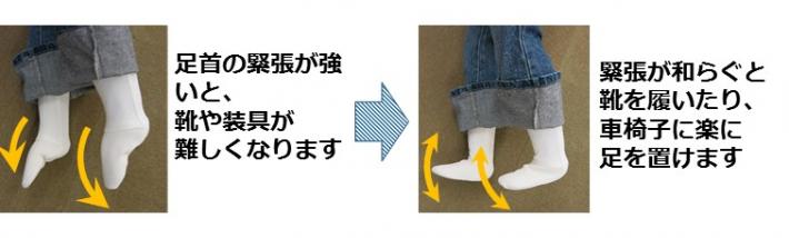 痙縮の足