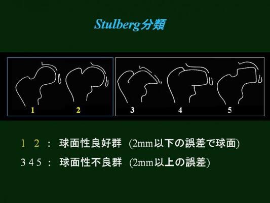 Stulberg分類の図