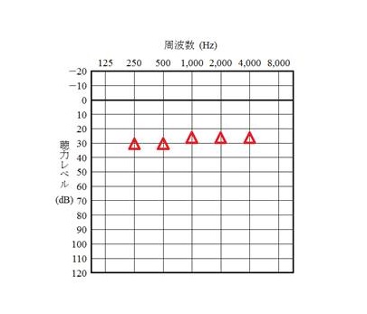COR検査結果