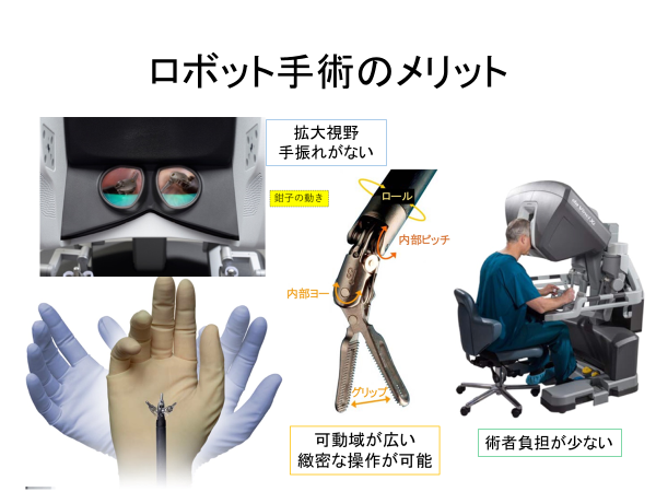 ロボット手術のメリット