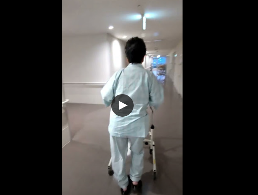 2.THA術後早期に杖歩行が可能になった動画