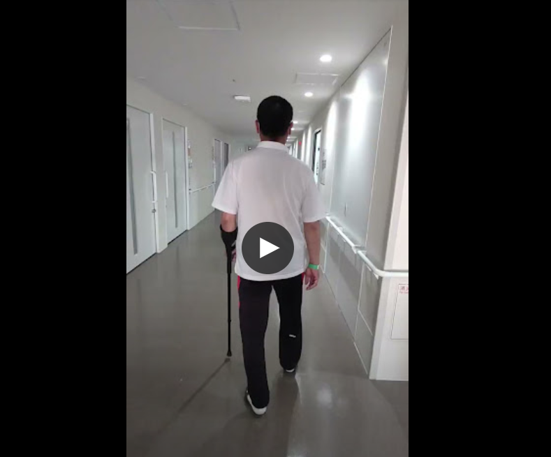 3.54歳男性右変形性股関節症術前動画