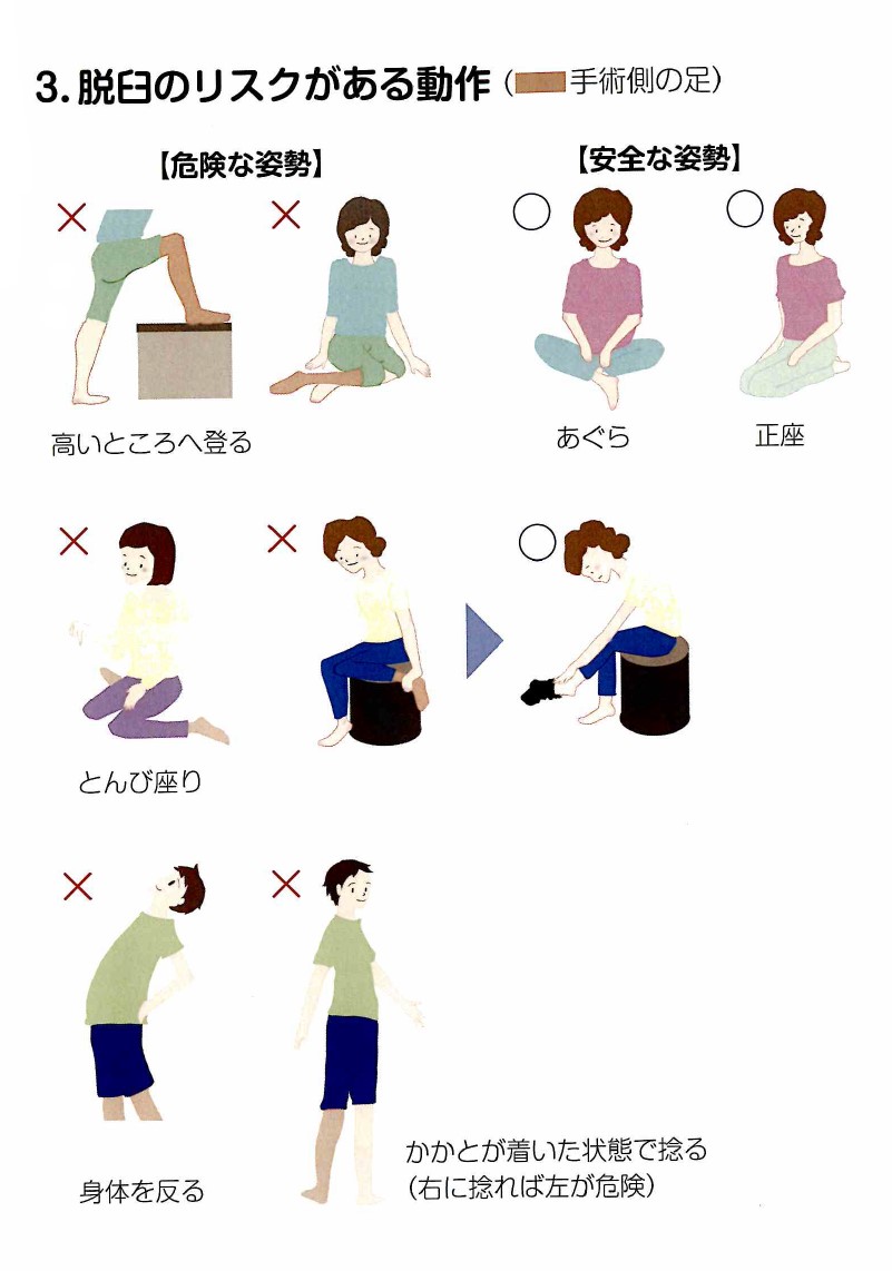 脱臼のリスクがある動作