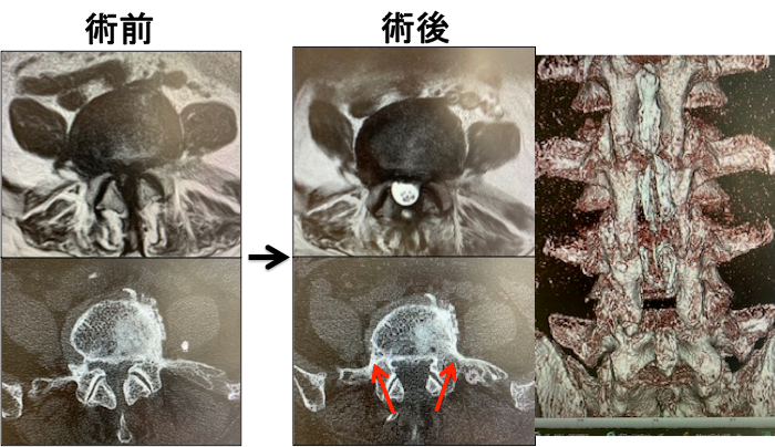 術前と術後