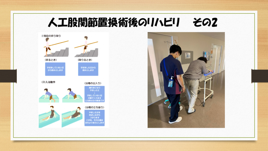 人工股関節置換術後の階段昇降や入浴時の注意点を示す画像です。
