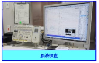 脳波検査
