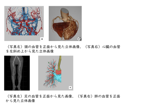 近年のCT検査の画像