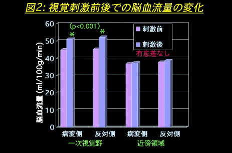 視覚刺激前後での脳血流量の変化の図