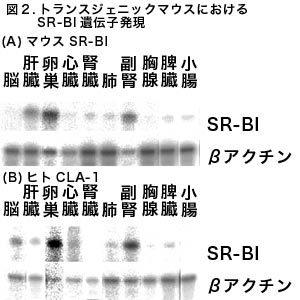 図2 トランスジェニックマウスににおけるSR-BI遺伝子発現