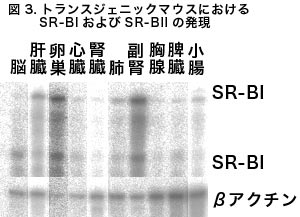 図3 トランスジェニックマウスにおけるSR-BI遺伝子発現
