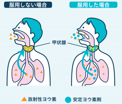 安定ヨウ素剤服用有無による効果