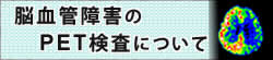 脳血管障害のPET検査について